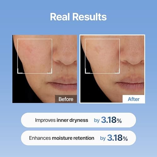 Meditherapy Hyaluronic Acid Serum XXL 150ml (5.07 fl.oz.) – Ultra Hydrating 333Serum for Glowing Skin, Face Moisturizer, Non-Sticky, Anti-Aging & Wrinkle Care, Korean Skin Care thumbnail 3