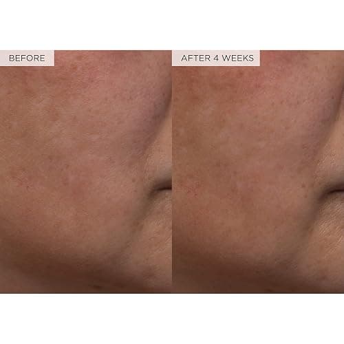 Glow Recipe PHA + BHA Face Toner - Korean Skin Care Pore Minimizer & Gentle Facial Exfoliator for Tightening, Hydrating & Exfoliating - Glycerin, Watermelon & Cactus Water (150ml) - 5 Fl Oz (Pack of 1) - Full Size thumbnail 7