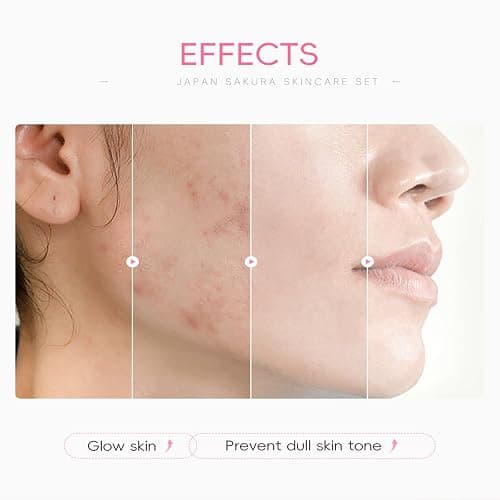 Skin Care Set For Teenagers Girls with Cute Mini Luggage,Sakura Skin Care Sets & Kits,Pamper Sets For Girls Gifts,Skincare Set,Serum,Cleanser,Sleep,Mud Mask,Lip Mask,Hair Pins (One Size, Sakura) thumbnail 6