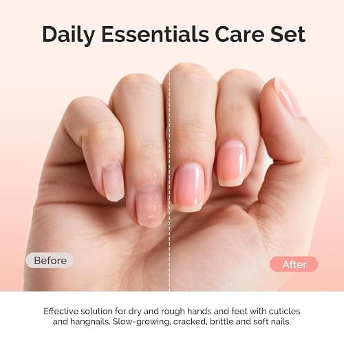 MelodySusie 25ML Cuticle Care Kit - Cuticle Oil and Cuticle Remover 2PCS | Cuticle Nourishes and Softener, Promotes Nail Growth and Strength for Home and Salon Use thumbnail 3
