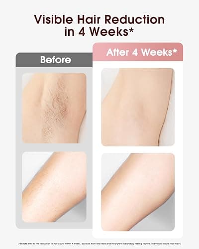 Haarlosy IPL Laser Hair Removal Device for Women and Men, Ice Cooling Painless Hair Remover Machine for Salon Quality Long Lasting Results at Home, for Face, Bikini Line, Armpit, Leg, Body, Pink thumbnail 3