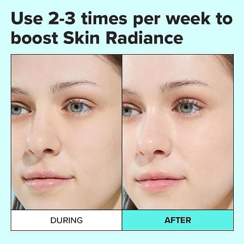 I DEW CARE Wash Off Face Mask - Chill Mo-Mint | Soothing Mask with Peppermint Leaf Extract, Korean Face Mask Skin Care for Face, 3.38 Oz thumbnail 7