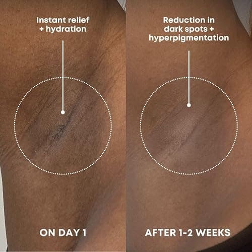 Bushbalm Dark Spot Exfoliating Scrub - Natural Body Scrub Exfoliant to Hydrated, Soften and Enhance Glow in Skin - Bermuda 236 ml thumbnail 3