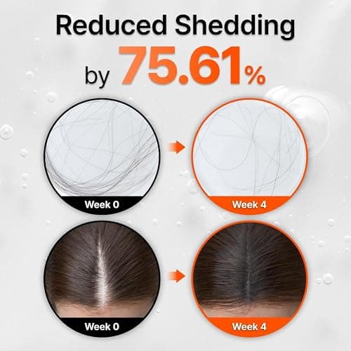 lilyeve GROWTURN Hair Growth Serum with Built-in Brush, Heartleaf-Derived Exosomes to Revitalize Hair, Hair Thickening, Hair Growth Accelerator - Korean Hair Care, 3.38 fl. oz. (Pack of 1) thumbnail 3