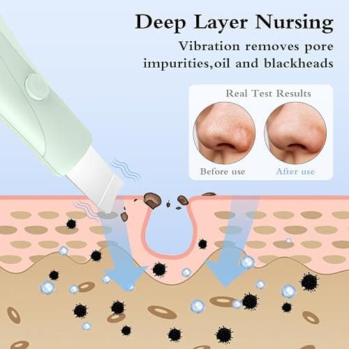 Skin Scrubber Face Spatula Skin Spatula Pore Cleaner Blackhead Remover Tools for Facial Deep Cleansing Skin Care Tool for Men and Women (Green) thumbnail 6