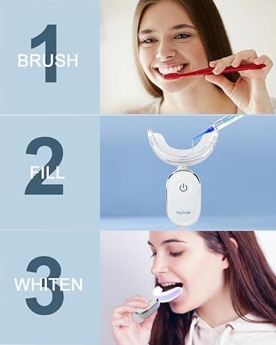 MySmile Teeth Whitening Accelerator Light, 28 LED Blue Light, Each 10 Minutes, USB Charger, Mouth Trays, 1 Pcs LED Light & 4ml Gel thumbnail 3