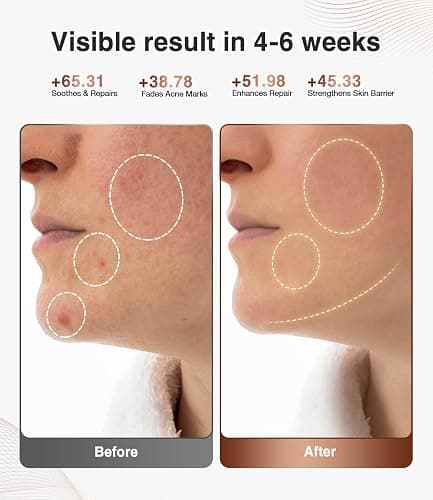 JOVS 4D Red Light Therapy Mask for Face with 4 Color Light Modes, Breathable Wireless 328 LEDs Face Mask with 850NM Near-Infrared Light, Portable LED Face Mask Light Therapy with Timer for Home Travel thumbnail 2