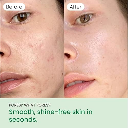QUIA Dual-Action Toner Pads – Gentle PHA Exfoliation for Sensitive Skin – Instantly Hydrate and Minimize Pores – 70 Soft-Touch Korean Textured Pads – Blackhead and Blemish Control thumbnail 2
