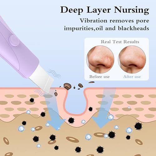 Skin Scrubber Face Spatula Skin Spatula Pore Cleaner Blackhead Remover Tools for Facial Deep Cleansing Skin Care Tool for Men and Women (Purple) thumbnail 6