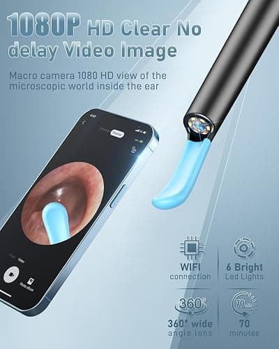 Ear Wax Removal Tool Camera - Ear Cleaner with Camera,1080P Otoscope, Ear Cleaning Tool with 4 Ear Spoon, Ear Camera for iPhone & Android Phones - Blue thumbnail 2