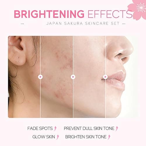 Skincare Gifts For Teenage Girls,Cherry Blossom Skincare Sets,Facial kit,Pamper Sets For Women Gifts,Skin Care Sets & Kits (One Size, Cherry Blossom-SetA-Base Moisturizing) thumbnail 2
