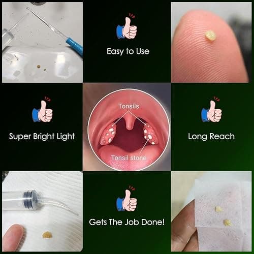 Tonsil Stone Remover Kit, Lighted, 5 Tips, Oral Irrigator for Bad Breath | 6.75" Tonsil stone removal kit with oral syringe & long tonsillolith pick, clean tonsil crypts for throat and oral care thumbnail 6