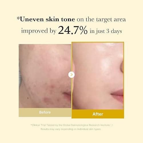 medicube Kojic Acid Turmeric Overnight Wrapping Peel Off Mask – Brightens & Defends Against Skin Stress for a Clear, Glowing Complexion, Korean Skincare, 2.53 fl. oz. thumbnail 4
