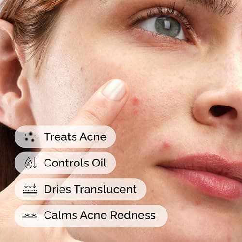 The Ordinary Sulfur 10% Powder-to-Cream Acne Spot Treatment Concentrate, Reduces Pimple Size and Zit Redness, 0.18 Oz thumbnail 2
