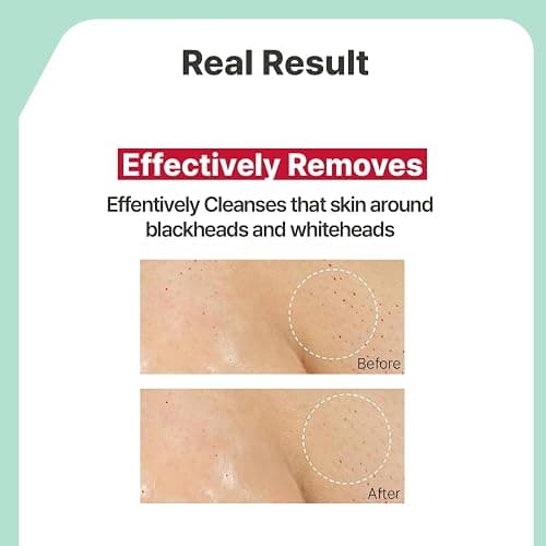 Illiyoon Gentle Deep Cleansing Oil | Lightweight Facial Cleanser with Coconut Oil & AHA/BHA for Makeup, Fragrance-Free, Sebum & Blackhead Removal, Korean Skin Care, 8.45 fl.oz. thumbnail 4