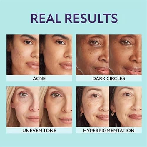 Crème Couvrante En Stick, Fond De Teint En Stick Chartming Changeant De Couleur, Convient à Tous Types De Peau,Fond De Teint 2 En 1 Avec Pinceau, Base De Maquillage Couvrante (Natural, 1PCS) thumbnail 7