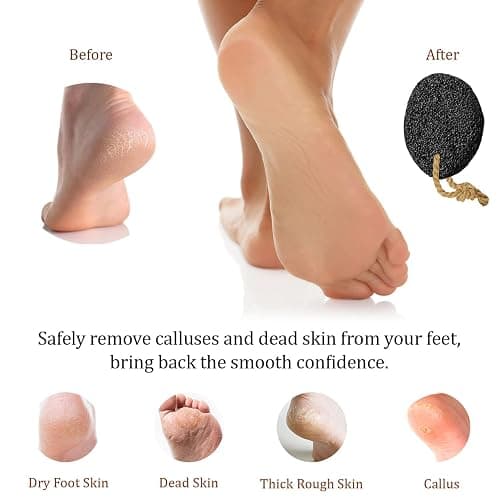 Pumice Stone - Natural Earth Lava Black - Callus/Corn Remover for Feet Heels and Palm - Pedicure Exfoliation Tool - Dry Dead Skin Scrubber - Health Foot Care thumbnail 3