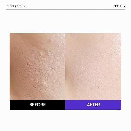 Pore Minimizer Serum | 9 Peptides, Vegan Collagen, Adenosine, PHA | Korean Pore Minimizer for Glass Skin, Anti-Aging, Hydration, Elasticity | 1.01 fl oz thumbnail 2