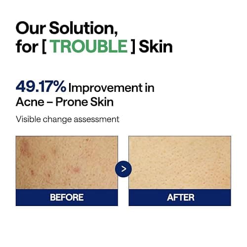 MEDIHEAL Teatree Trouble Pad - Square Cotton Facial Toner Pads with Tea Tree & Lactobacillus - Soothing to Calm Sensitive & Acne Prone Skin- Vegan Face Gauze 100 thumbnail 4