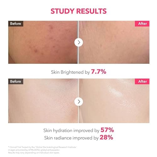 APRILSKIN TXA Pink Capsule Gel Mask | Overnight Face Mask for Glass Glow Skin I 99% High-Purity Tranexamic Acid 3 for uneven skin tone I Elasticity, Hydrating and Firming I Korean Skincare I 30g x 4ea thumbnail 6