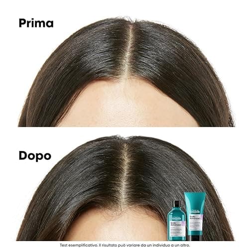 L'Oréal Professionnel Paris Shampoo Lenitivo, Per Cuoio Capelluto Sensibile, Per Capelli Luminosi e Setosi, Con Niacinamide, Anti-Discomfort, Scalp Advanced, 300 ml thumbnail 4