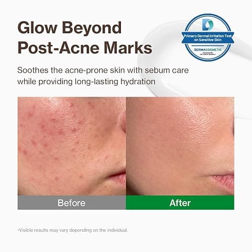 YUMU Cica Exosome Zinc Blemish Relief Cream, Face Moisturizer for Sensitive, Acne-Prone Skin, Lightweight, Breakouts, Barrier Repair, Hydration, Soothing, Oil-Free, Korean Skincare (80 ml/2.70 fl.oz.) thumbnail 2
