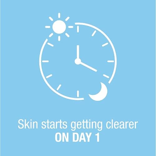 Neutrogena On-The-Spot Acne Spot Treatment Cream with 2.5% Benzoyl Peroxide, Gentle Face Blemish Medicine for Acne-Prone Skin, Vanishing Formula, Clinically Proven Day-1 Results, 0.75-Ounce Tube - 0.75 Ounce thumbnail 5