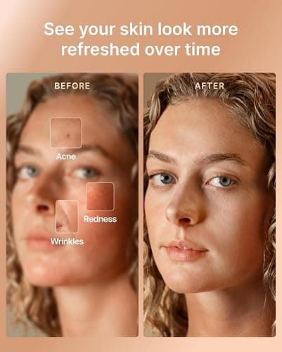 RENPHO Red Light Therapy Mask for Face, FDA-Cleared,Birthday Gifts for Wife | 324 LEDs, 3 Modes, Wrinkle Treatment, Anti Acne, Red Blue NIR, Full Face Coverage, Cordless, Home Facial Skincare for Women thumbnail 2