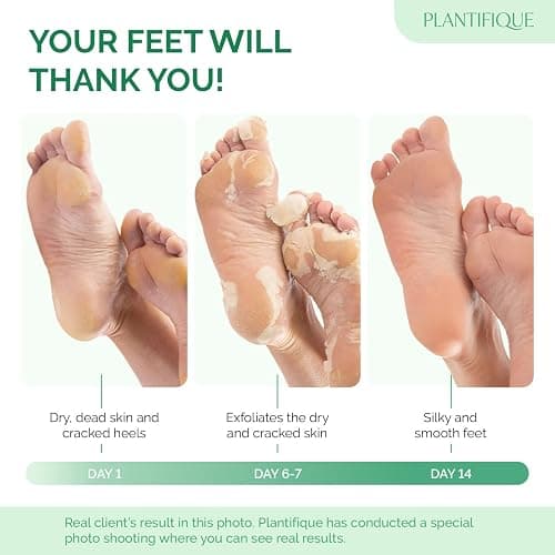 PLANTIFIQUE Foot Peeling Mask 2 Pack | Dermatologically Tested Repairs Heels & Removes Dry Dead Skin for Baby Soft Feet | Exfoliating Foot Peel Mask for Dry Cracked Feet | Peach thumbnail 2
