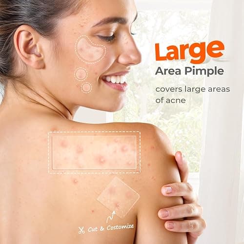 TKTK Large Pimple Patches for Face & Body, 68x27mm, 5 Sizes 136 Count | XL Hydrocolloid Bandage, Acne Patches Absorb Breakouts for Forehead, Chin, Nose, Chest and Back, Gentle on Sensitive Skin thumbnail 3