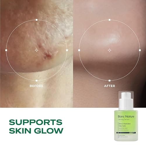 Blanc Nature Calming Serum, Soothing and Hydrating Serum for All Skin Types with Hyaluronic Acid, Centella Asiatica and Panthenol, Korean Skincare for Glass Skin, 1.01 fl oz (30 ml) thumbnail 4