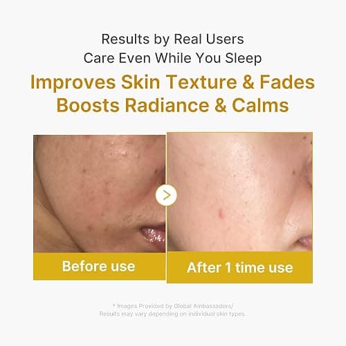 medicube Wrapping Mask Kojic Acid, Turmeric, Vitamin C Overnight Peel Off Facial Mask | Brighten & Defends Against Skin Stress for a Clear, Glowing Complexion | Korean Skin Care, 2.53 fl.oz thumbnail 5