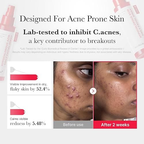 medicube Swipe & Spray Red duo for Troubled Skin: Red Succinic Acid Panthenol Facial Peeling Pads and Power Soothing Spray thumbnail 5
