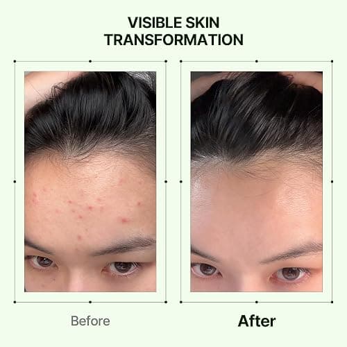 Orien Mugwort Zero Film Toner 5.41 fl.oz. 160ml ㅣpH5.5 Calming, Soothing, Hydrating Spray Toner thumbnail 6