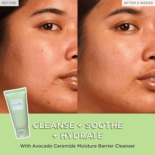 Glow Recipe Fruit Babies Skincare Kit - Gift Set with Ceramide Facial Cleanser + BHA Toner + Vitamin C Eye Cream + Hyaluronic Acid Cream + Niacinamide Dew Drops (5 Count) thumbnail 3