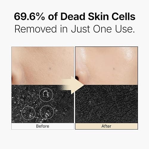 MANYO Galactomy Enzyme Peeling Gel, Face and Body Scrub, Dead Skin Remover, Blackhead Remover, Korean Exfoliating Gel, Korean Skin Care, 2.5fl oz (75ml) thumbnail 6