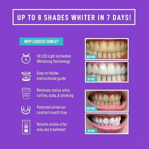iSmile Teeth Whitening Kit - LED Light, 35% Carbamide Peroxide, (3) 3ml Gel Syringes, (1) Remineralization Gel, and Tray. thumbnail 2