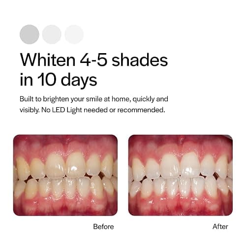 Opalescence GO 15 Whitening Bundle - (7 Treatments) Hydrogen Peroxide Prefilled Teeth Whitening Trays and Travel Sensitive Whitening Toothpaste 1 Oz - Mint Flavor- Includes a Toothbrush - 6288-1T thumbnail 4