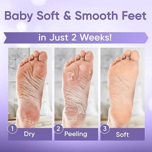 Foot Peel Mask - Foot Mask for Baby Soft Skin - Remove Dead Skin, Dry, Cracked Feet & Callus, Foot Spa, Made with Aloe Vera Extract for Women and Men (2 Pair (Pack of 1), Lavender) thumbnail 4