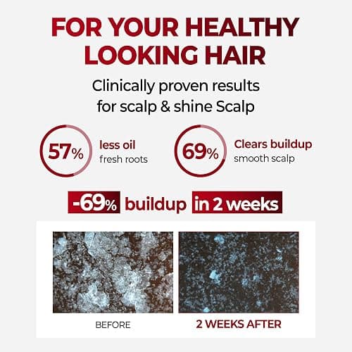 KUNDAL Caffeine Scalp Shampoo [Baby Powder] – Sulfate-Free Korean Hair Care with Menthol & Botanical Extracts – For Fuller-Looking Hair, Scalp Refresh & Strength – 16.9 Fl Oz, Stocking Stuffers thumbnail 2