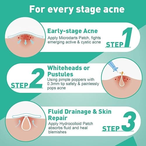 3-Step Microdart Pimple Patches Set – 83 Count, including 9 Microdarts Pimple Patches, 50 Pimple Poppers, and 24 Hydrocolloid Patches thumbnail 2