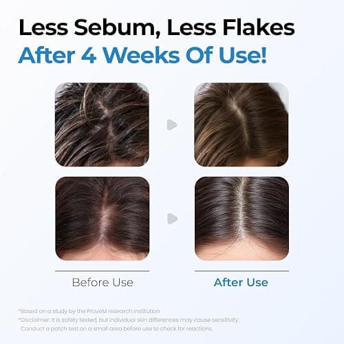 Seapuri Scalpy Bubble Tonic: Soothing Scalp Toner for Hair Retention & Less Shedding | Instant Cooling Relief for Oily Scalp & Itchy Redness | Salicylic Acid Detox for Dandruff & Buildup thumbnail 5