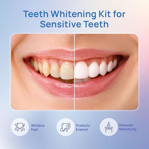 Whitebite Pro Vertical Dual LED Teeth Whitening Kit with Charging Dock – Professional at-Home Dental Whitening Machine with Pens, Tooth Stain Remover for Sensitive Teeth, Travel-Friendly Oral Hygiene thumbnail 8