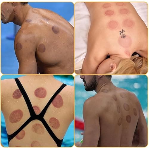 Cupping Kit - 12 cups thumbnail 8