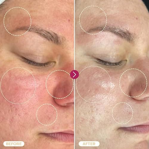 BASE LABORATORIES Hypochlorous Acid Spray for Face & Skin | 8 oz | Facial Spray Daily Skin Repair Solution for Sensitive Skin, Redness, Irritations, Eczema, Acne. Hypochlrous HOCL Molecule Spray thumbnail 5