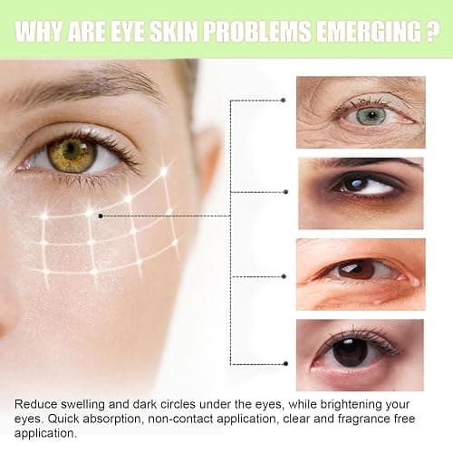 15ml Skincare Eye Cream,Skincare Morning Rays Brightening Eye Cream,Slam Dunk Hydrating Face Moisturising Cr/eam,Face Moisturizer,Vitamin C Under Eye Cre/am,Calm for Dark Circles thumbnail 6