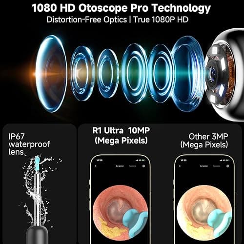 BEBIRD R1 Ultra Ear Wax Removal, Ear Cleaner with Camera Ear Scope, Wax Remove Ear Pick with Ear Otoscope Tweezers, Visual Dropper Cleaning Kit, Ear/Nose/Throat Examination Tool for Family thumbnail 3