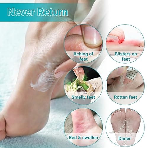 LMNOOP Athletes Foot Treatment Cream, Maximum Strength for Athlete's Foot (Tinea Pedis), Itching, Blister, Burning, Cracking, Scaling, Beriberi,Natural Herbs Antifungal Foot Cream thumbnail 3