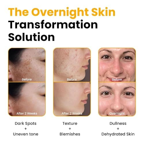 QUIA Collagen + Turmeric Overnight Wrapping Mask Duo – Firming and Hydrating Peel-Off Set for Elasticity, and Glow – Korean Skincare 2 x 75ml thumbnail 6