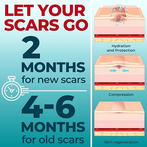 Medical Grade Silicone Scar Tape - 1.6”x150” - Visible Difference on Keloid & С-Section - Reusable Silicone Scar Sheets - Easy to Use - 150"x1.6" - Beige thumbnail 6